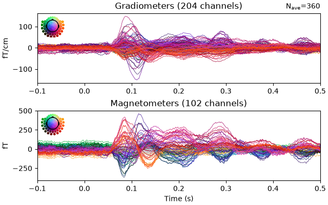 Gradiometers (204 channels), Magnetometers (102 channels)