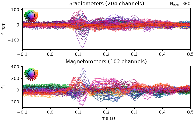 Gradiometers (204 channels), Magnetometers (102 channels)