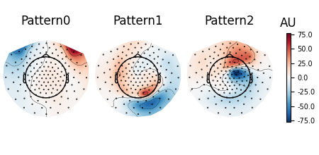 Pattern0, Pattern1, Pattern2, AU