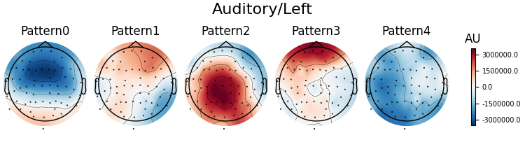 Auditory/Left, Pattern0, Pattern1, Pattern2, Pattern3, Pattern4, AU
