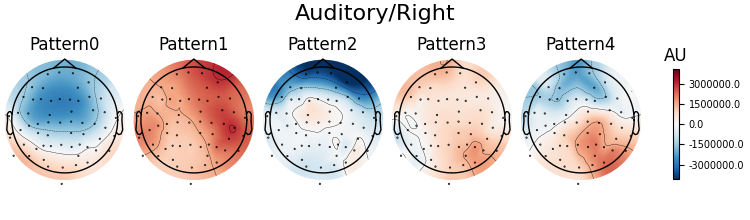 Auditory/Right, Pattern0, Pattern1, Pattern2, Pattern3, Pattern4, AU