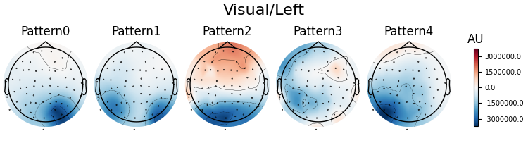 Visual/Left, Pattern0, Pattern1, Pattern2, Pattern3, Pattern4, AU