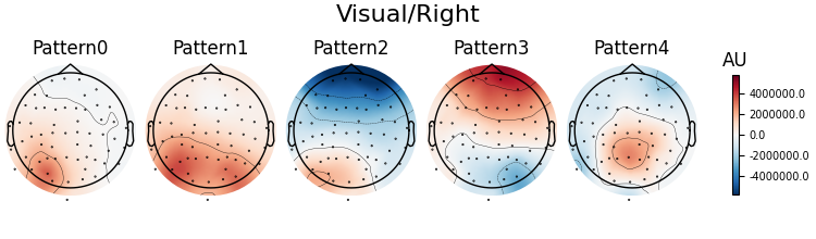 Visual/Right, Pattern0, Pattern1, Pattern2, Pattern3, Pattern4, AU