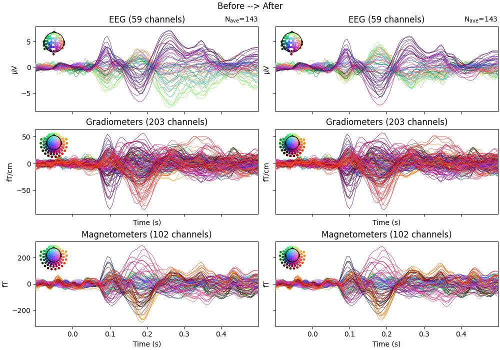 Before --> After, EEG (59 channels), EEG (59 channels), Gradiometers (203 channels), Gradiometers (203 channels), Magnetometers (102 channels), Magnetometers (102 channels)