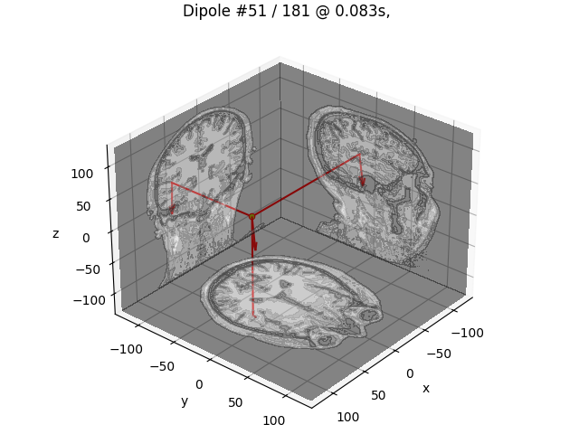Dipole #51 / 181 @ 0.083s, GOF: 31.5%, 45.7nAm MRI: (47.3, -17.2, 30.2) mm