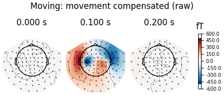 Moving: movement compensated (raw), 0.000 s, 0.100 s, 0.200 s, fT