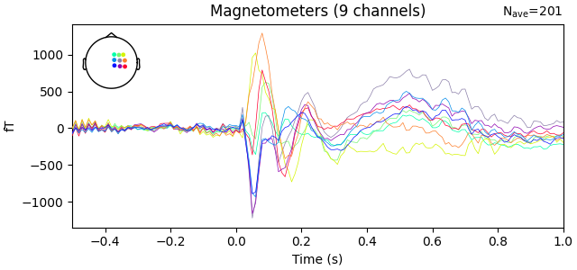 Magnetometers (9 channels)