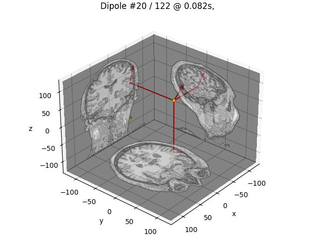 Dipole #20 / 122 @ 0.082s, GOF: 65.3%, -54.3nAm MRI: (-54.7, -16.2, 25.7) mm