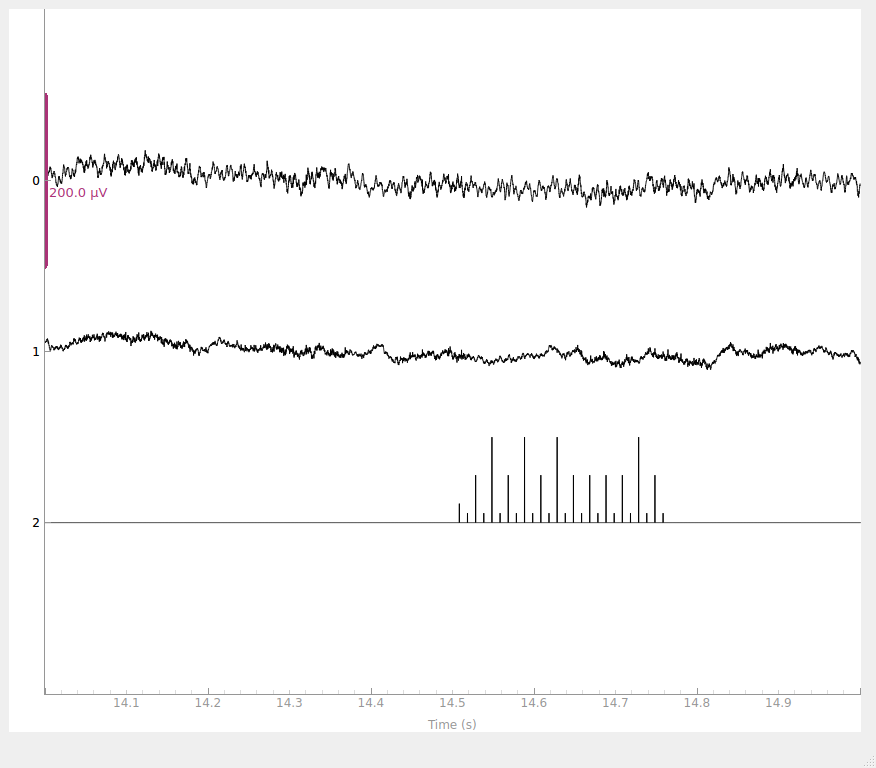 eeg reading