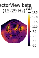 VectorView beta (15-29 Hz), AU