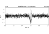 Time-frequency on simulated data (Multitaper vs. Morlet vs. Stockwell)